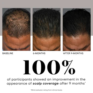 Plated Hair Serum | Hair Growth & Scalp Health Treatment