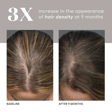 Plated Hair Serum | Hair Growth & Scalp Health Treatment