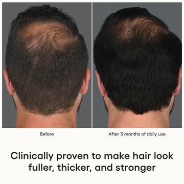 Plated Hair Serum | Hair Growth & Scalp Health Treatment